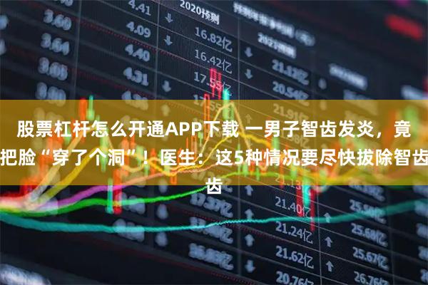 股票杠杆怎么开通APP下载 一男子智齿发炎，竟把脸“穿了个洞”！医生：这5种情况要尽快拔除智齿